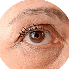 Contorno de ojos, semana 1